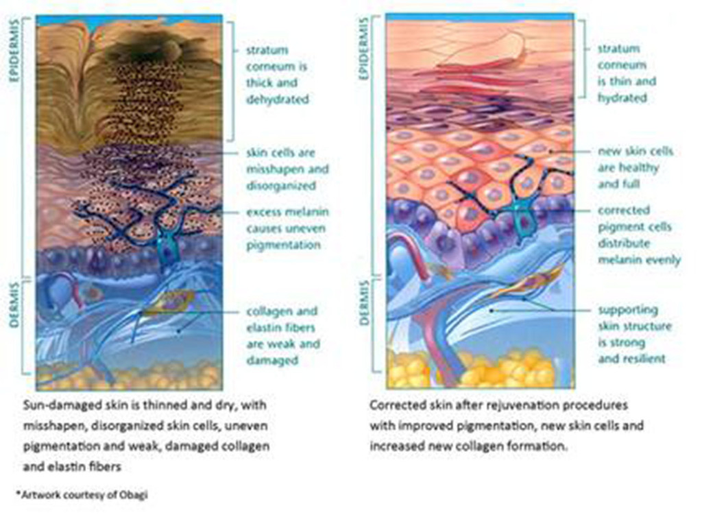 Damage skin before and after