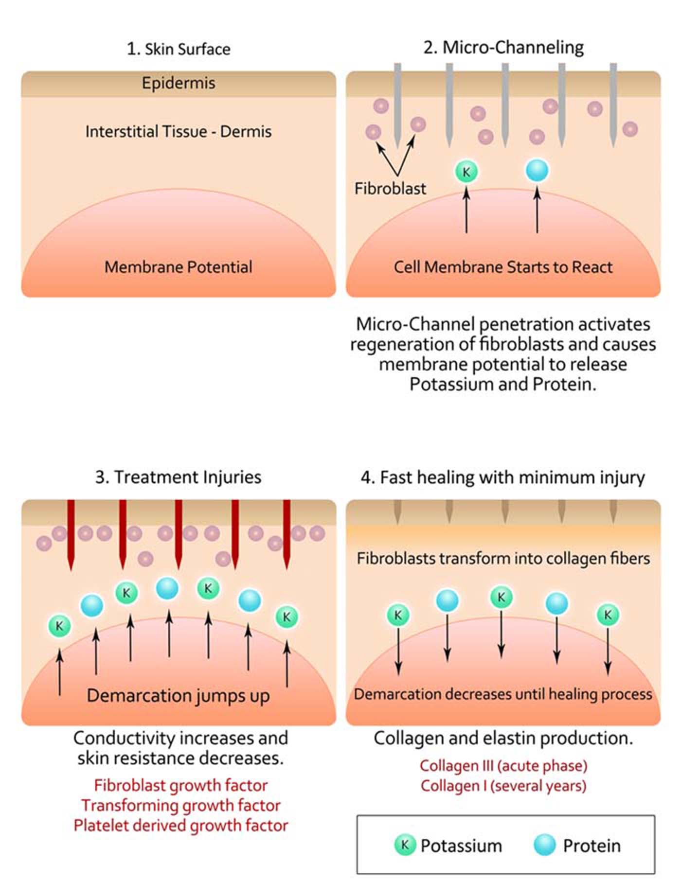 Microneedling Chart