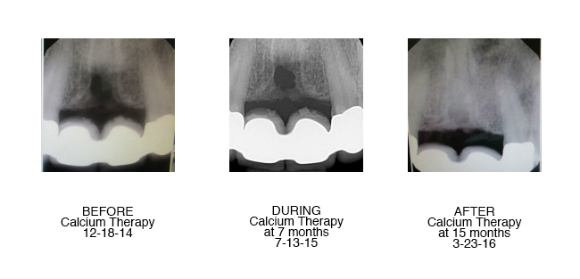 teeth