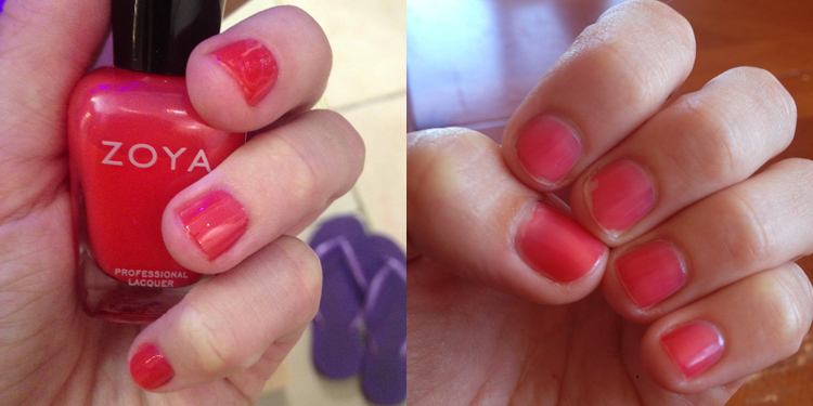 zoya_beforeafter